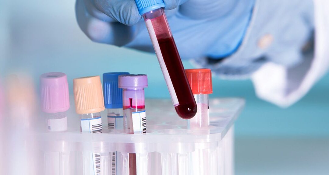 Oxford Scientists Develop Revolutionary Blood Test for Early Cancer Detection