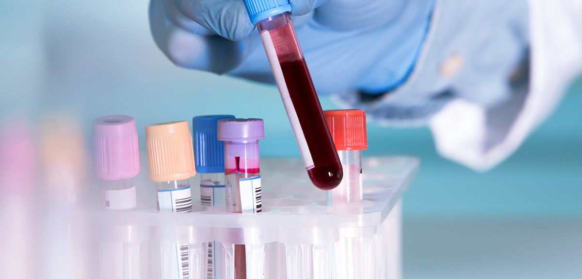 bcar_bloodwork