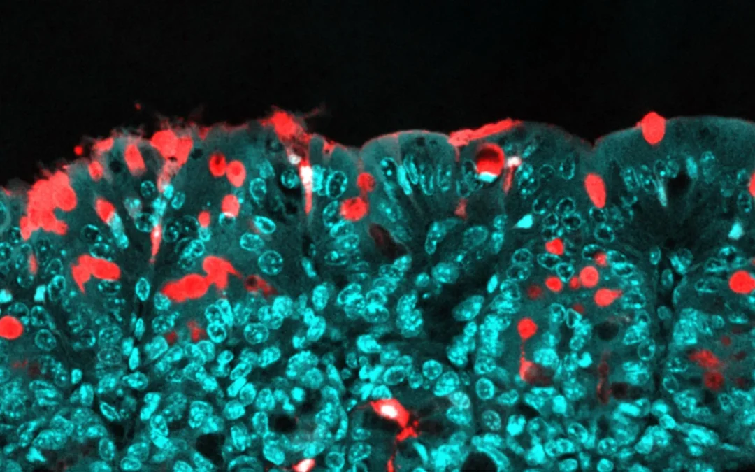 Common Food Additives May Influence Long-Term Gut Health